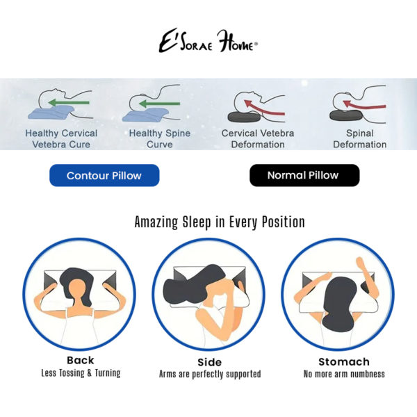 Cloud Cervical Memory Pillow - Image 2