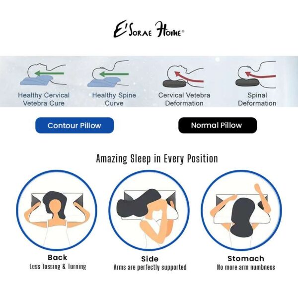 Cloud-Cervical-Butterfly-Memory-Pillow-1.jpg Cloud Cervical Memory Pillow